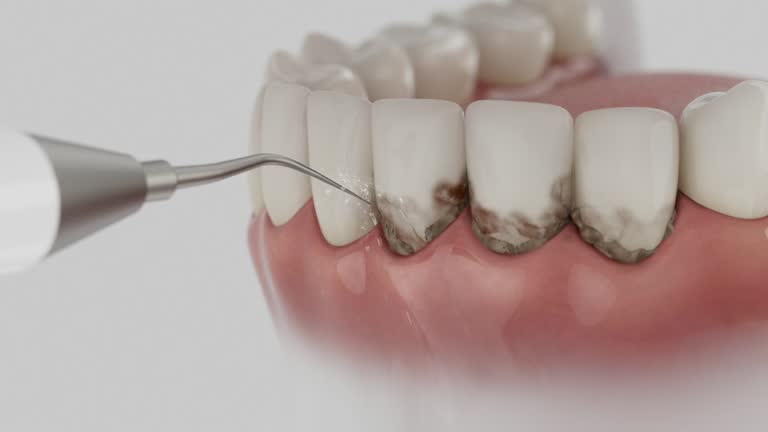 Reliable Tooth Extraction contractor in Jackson County County, MO by Dentist Open Now
